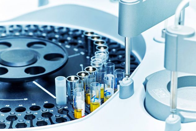 urinalysis